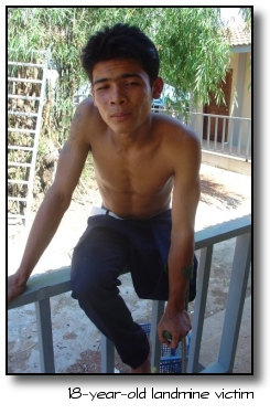 Male Amputee