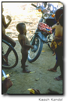 Malnourished child at Ksach Kandal